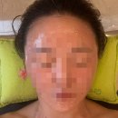 차옴테라피 네이버블로그