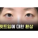 압구정집성형외과 이미지