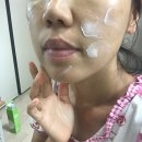 에이씨솔루션 | 여드름크림 일루미엘 에이씨 솔루션 보습크림 후기