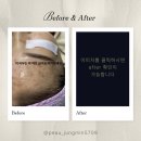 벽산코스메틱 | 수안동 압출흉터관리 에스테틱 피부관리실 피부가 어떤지부터 확인하세요