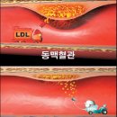 콜레스테롤를 낮추는 음식 베스트 9 이미지