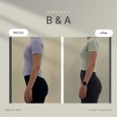 비벨라핏 이미지