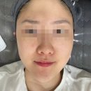 대연동피부관리 라퓨어왁싱 플라즈마 후기