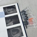 시정약국 | 준비] 1차 시험관 타임라인 | 시험관 비용 | 시험관 후기 | 신선배아이식 | 3일배양 | 난자채취주의사항