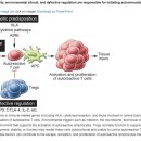 쇼그렌증후군 원인 증상 일반적이지 않은 경우 중 small fiber neuropathy