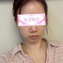 굿마인드의원 | 아비쥬 노원| 인모드Fx 중독자가 말하는 솔직 후기