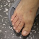 백선세탁 이미지