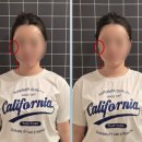 지오테라피 | 창원 테라피 | 창원 부종케어 마사지 지오테라피 후기