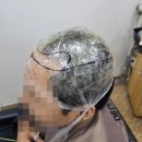 윤지영헤어 | 부산 덕천동 남자 맞춤가발 30대 활동적인 남성 고정식 가발 머리 밀지 않고 시원하게