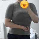 팔뚝지방흡입부작용 없이 송도비만클리닉 지흡 후 행복한 사람 후기♡