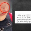 패대기