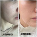 리셀라인 이미지
