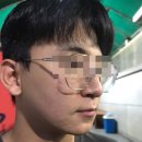 원한의원 | [구로한의원]한의원에서 10만원대에 풀페이스 끗쥬란힐러 시술후기(성분=리쥬란힐러)💉