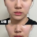 릴리즈 | 릴리즈세럼 스피큘세럼 속건조세럼 후기