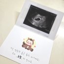 이화더블유산부인과의원 네이버블로그