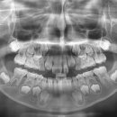 에스플란트치과병원 이미지