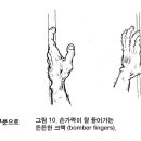 어렵고 힘든 가느다란 크랙에서의 재밍 테크닉 이미지