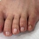 레푸스인하대역점 내성발톱 무좀발톱 발각질 문제성발 | 인천발각질 레푸스 인하대역점 내성발톱 무좀발톱 발각질 문제성발방문후기입니다