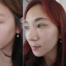 플레인의원 이미지