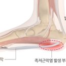 엑스(x)휘트니스 이미지