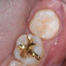 비욘드치과기공소 이미지