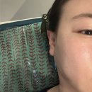 강저로 | 제천피부관리 에스테틱 은겸 모공관리 받은 후기