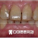 독일튼튼치과 이미지