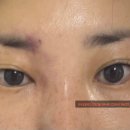 논현로1L 이미지