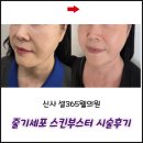 아주웰이비인후과의원 | 줄기세포 스킨부스터 전문병원 신사 셀365웰의원 내돈내산 후기(효과, 통증, 비포에프터)