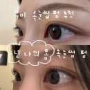 볼로그 구미옥계점 | 구미 옥계 속눈썹 펌 넌 나의 봄 시술 후기 전/후 사진