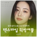 매몰 쌍수 붓기 실밥 후기 풀림 관리하는 방법