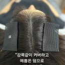 광진구 건대두피문신 만족할수 있을까요?