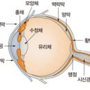 망막정맥 폐쇄 이미지