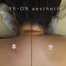 예온에스테틱