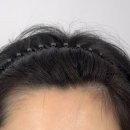 원스칼프 이미지