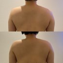 수앤수병원 | 부천 바디관리 아픈 곳 나아지는 수앤수뷰티끄 후기
