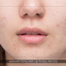 백옥피부샾
