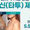 마침표성형외과의원 네이버블로그