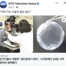 각막이식 수술 필요 없는 새로운 렌즈 이미지