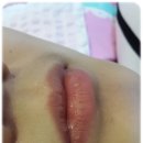 5457 | 대구 인중 왁싱) 여자 콧수염 왁싱 후기