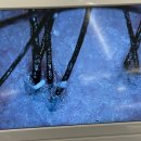 상록수 약국 | 상록수역 두피관리 잘하는 미용실 지성두피 유분관리 리얼 후기