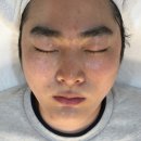 메디칼자이 | 수원피부관리 플레브에스테틱 트러블, 모공, 색소잡티 트라이엄 대만족 후기