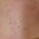 에스준의원 이미지