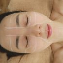 상도동리프팅 맞춤디자인 하이푸리프팅 통증 붓기 부작용 한달후기