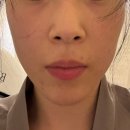 파리바게트진동점 | 영등포 양평동 목동 다이어트 아실리아 목동점 바이오포톤 체험 후기