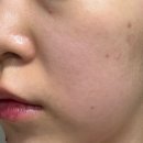이지유스킨케어 | 영 내돈내산 커버 메이크업 뷰티 제품 실제 사용 후기 및 할인 가격 성분 정보 잡티 개선 피부 타입 추천