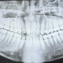 서울이턱사랑니치과의원 이미지