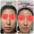 두둥...르시즈 스킨케어 사용3주후기