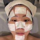 스킨프라자21 | 동탄에스테틱 피부관리 가성비 스킨앤유 아쿠아필 받고 옴