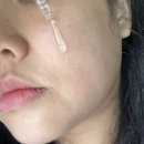 100-1-000172 | [더트포비아] 이펙텀 디:솔루션 앰플 , 리얼후기, 앰플추천, 트러블관리, 모공, 피지, 블랙헤드...